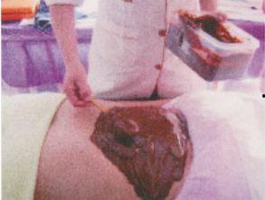 泥灸操作视频,轻松掌握养生保健新技能