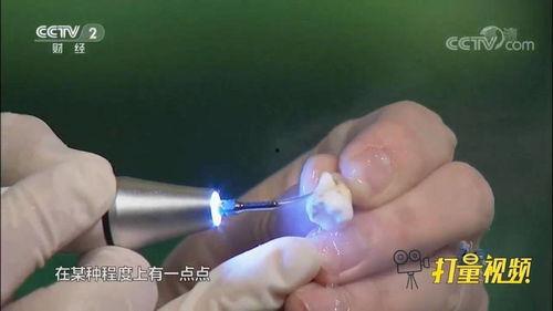 洗牙视频,跟随视频学习口腔清洁新技能