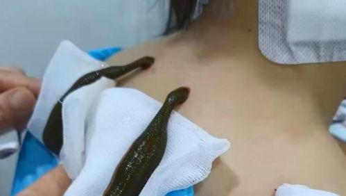 蚂蝗的视频,揭秘自然界的奇妙之旅