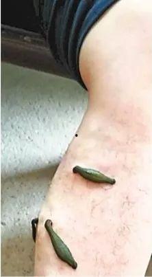 蚂蝗的视频,揭秘自然界的奇妙之旅