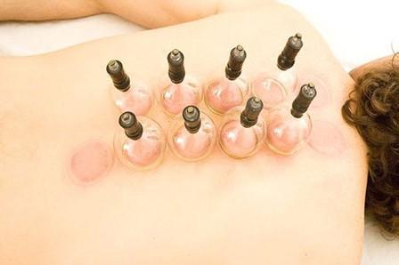 拔罐减肥视频教程全集,轻松掌握居家瘦身秘诀