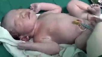 胎儿视频,揭秘宝宝在母体内的奇妙旅程