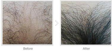 阴毛视频,私密部位的生理与美学探讨